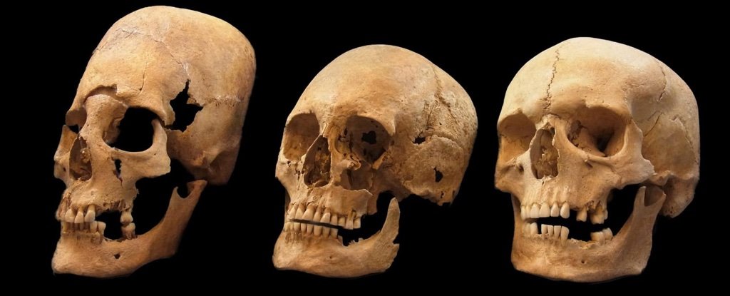 Elongated skulls Bavaria